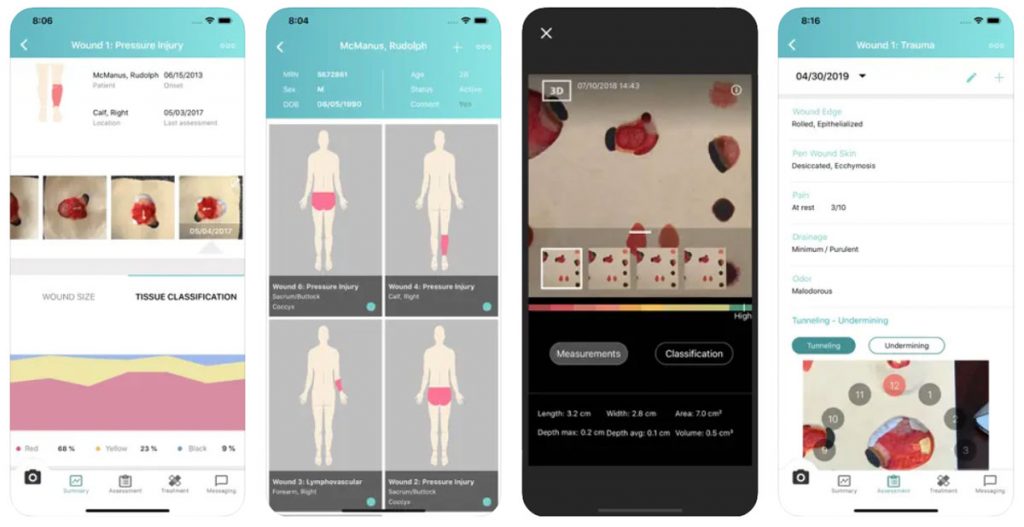 eKara inSight app for ulcer and wound management.